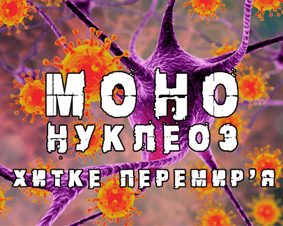 Епштейно-Барр інфекція - клініка лікаря Дубровського