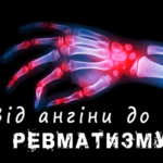 Лікування ангіни – клініка лікаря Дубровського