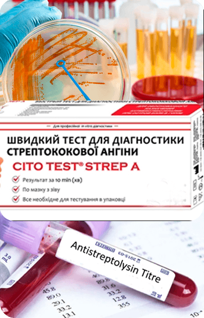 Діагностика ангіни - клініка Дубровського
