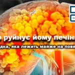 Біліарний гепатит - блог Дубровського