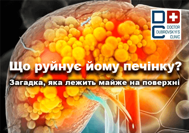 Біліарний гепатит - блог Дубровського