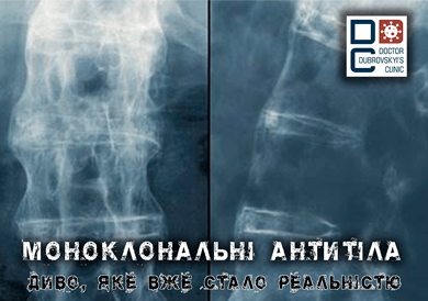 Про антитіла та хворобу Бехтерева